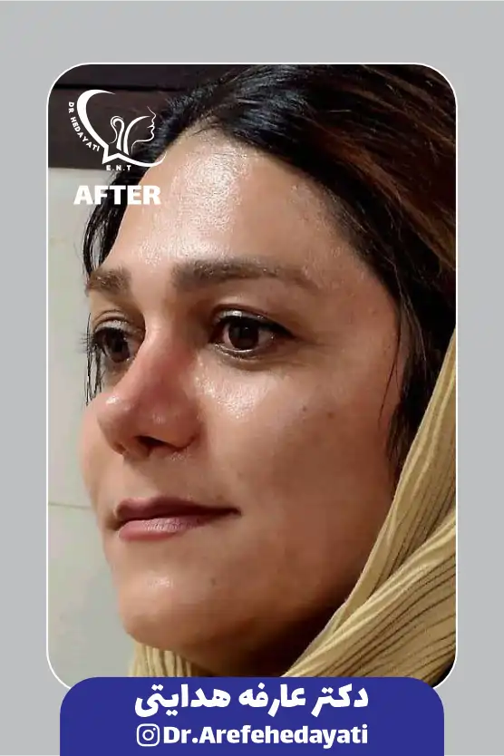 بعد نمونه کار دکتر عارفه هدایتی 10