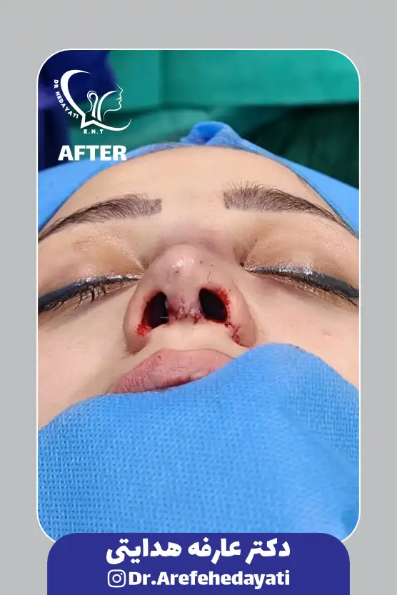 بعد نمونه کار دکتر عارفه هدایتی 3
