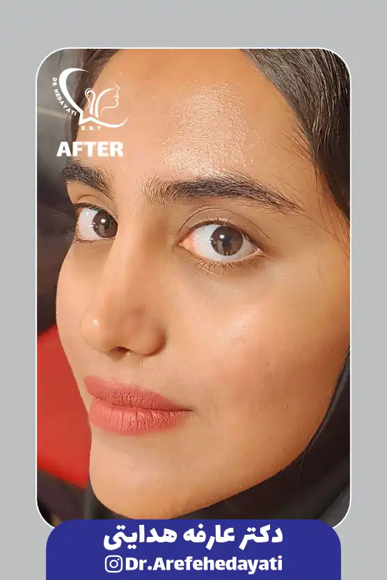 بعد نمونه کار دکتر عارفه هدایتی 5