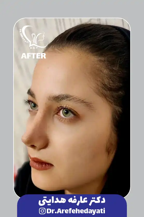 بعد نمونه کار دکتر عارفه هدایتی 6