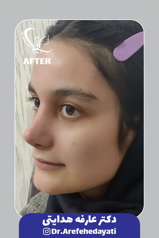 بعد نمونه کار دکتر عارفه هدایتی 7