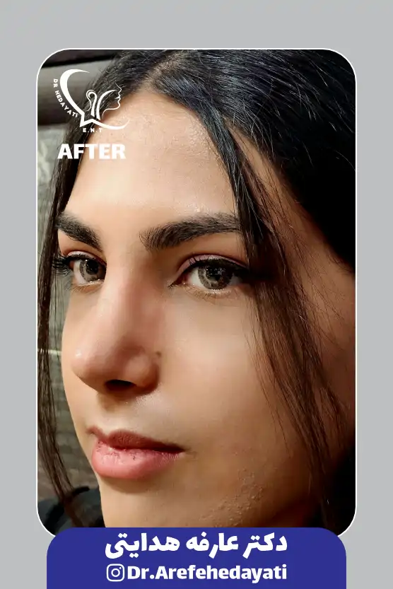 بعد نمونه کار دکتر عارفه هدایتی 9