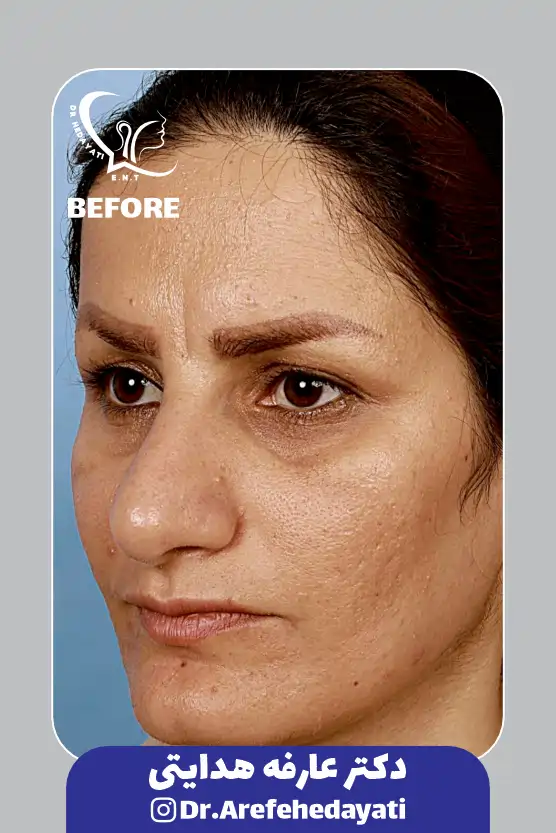 قبل نمونه کار دکتر عارفه هدایتی 4