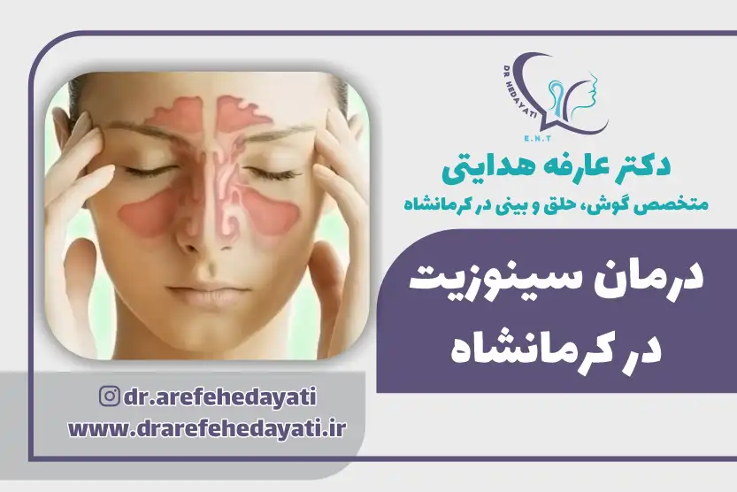 بهترین دکتر سینوزیت کرمانشاه