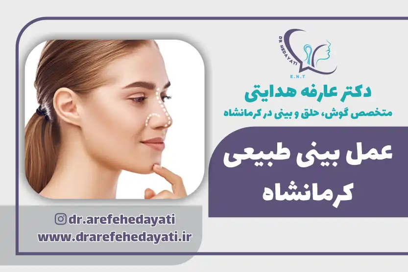 عمل بینی طبیعی کرمانشاه