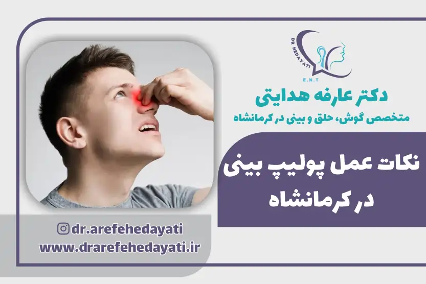 نکات عمل پولیپ بینی کرمانشاه، دکتر عارفه هدایتی