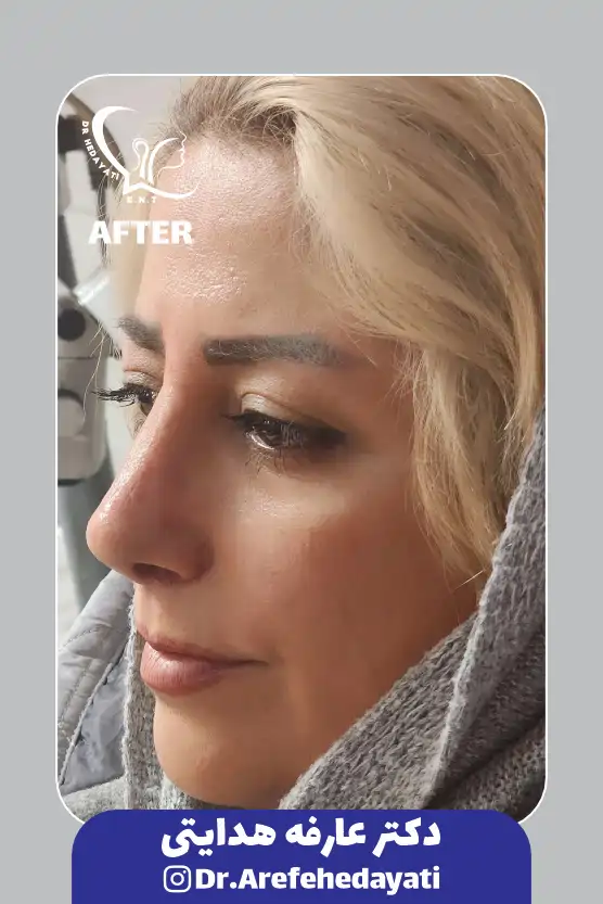 بعد نمونه کار دکتر عارفه هدایتی14