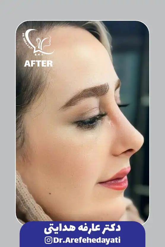 بعد نمونه کار دکتر عارفه هدایتی15
