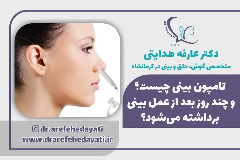 تامپون بینی چیست؟