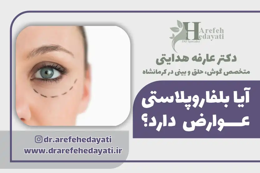 آیا بلفاروپلاستی عوارض دارد؟ عوارض جراحی پلک چیست؟