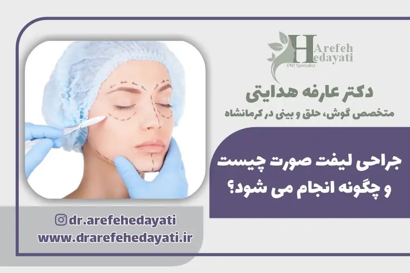 جراحی لیفت صورت چیست و چگونه انجام می شود؟