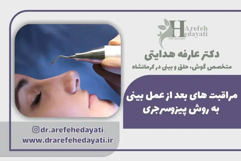 مراقبت های بعد از عمل بینی به روش پیزوسرجری