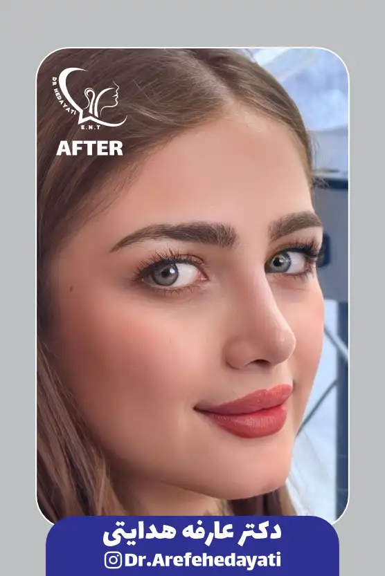 نمونه کار بعد 2