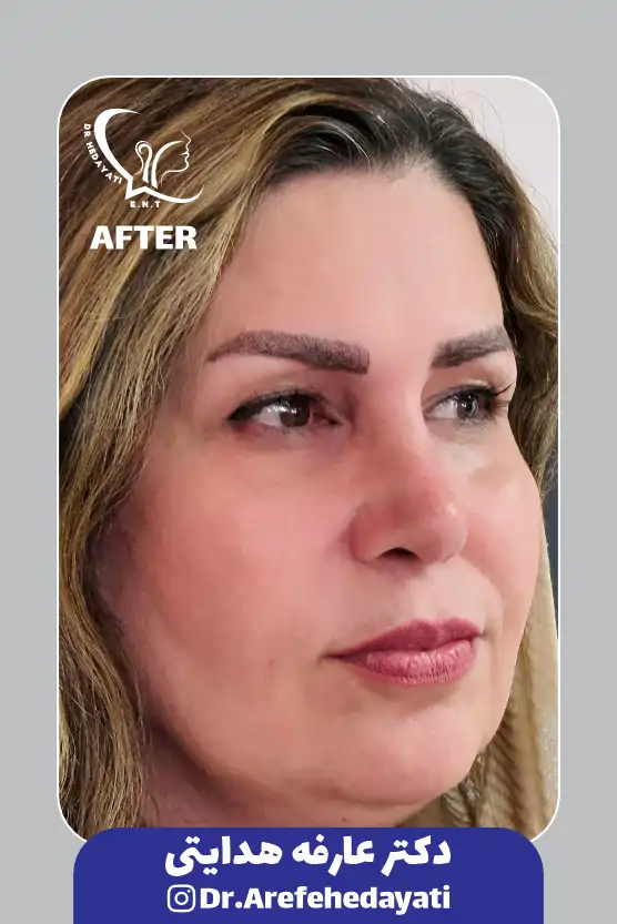 بعد 2