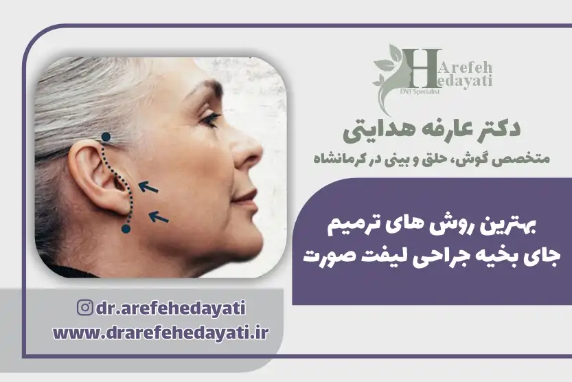 بهترین روش های ترمیم جای بخیه جراحی لیفت صورت