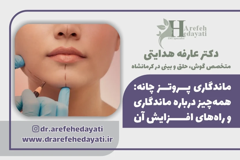 ماندگاری پروتز چانه همه چیز درباره ماندگاری و راههای افزایش آن