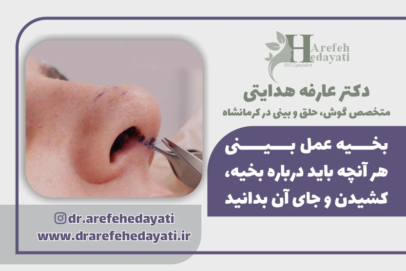 بخیه عمل بینی هر آنچه باید درباره بخیه، کشیدن و جای آن بدانید