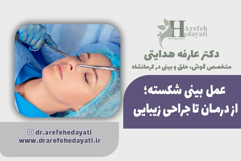 عمل بینی شکسته؛ از درمان تا جراحی زیبایی