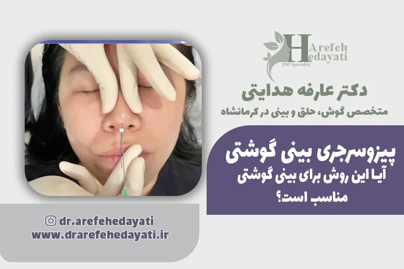 پیزوسرجری بینی گوشتی؛ آیا این روش برای بینی گوشتی مناسب است؟